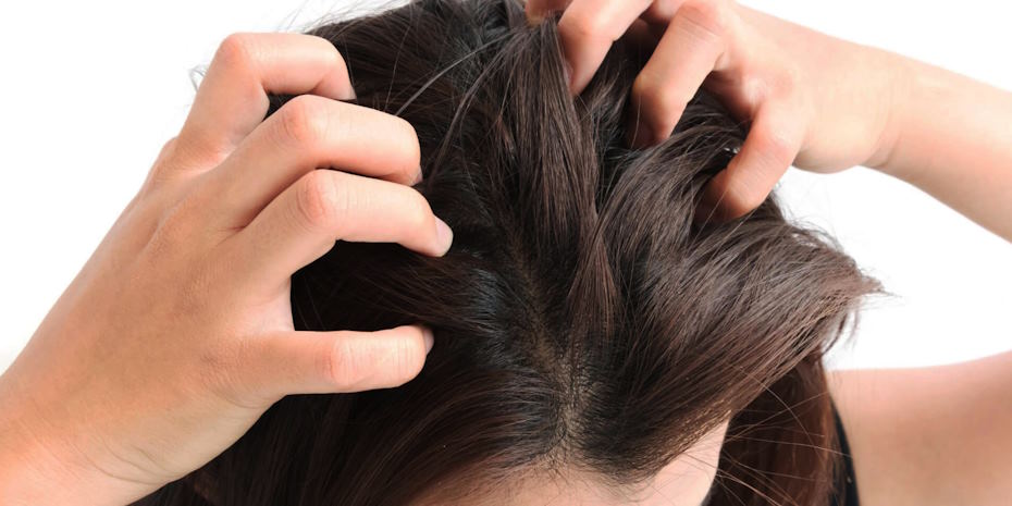 address dry scalp issues